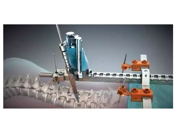 老齡化社會(huì)下的醫(yī)療設(shè)備需求